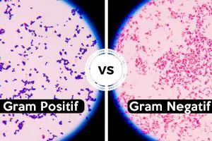 perbedaan bakteri gram positif dan bakteri gram negatif